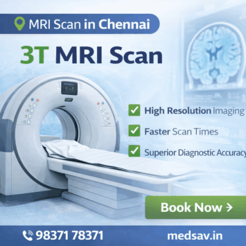 3t mri scan in chennai