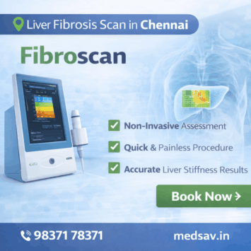 fibrosis scan in chennai